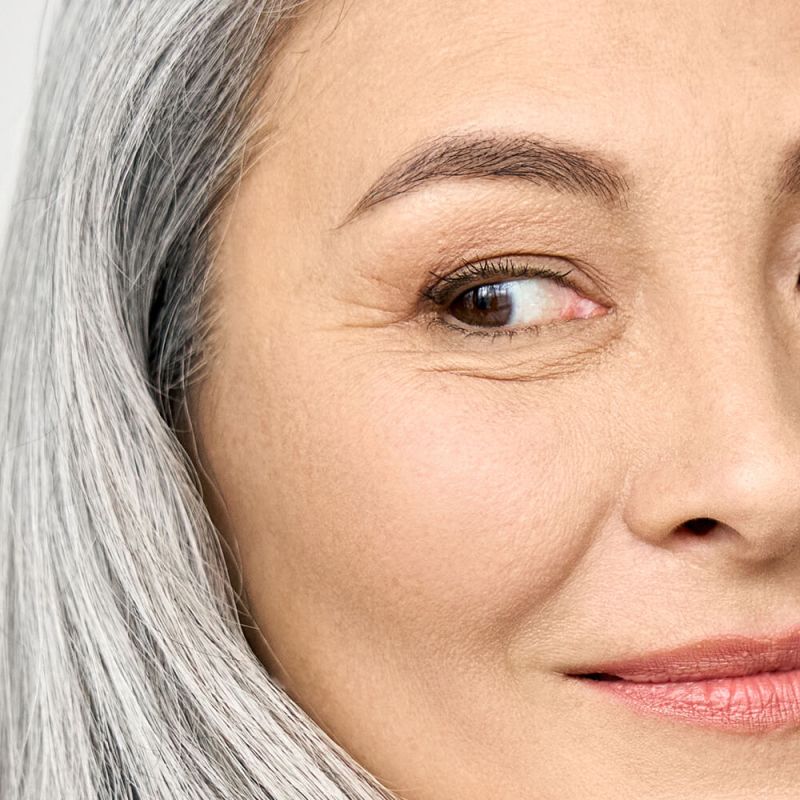 Asian woman with Fine Lines & Wrinkles