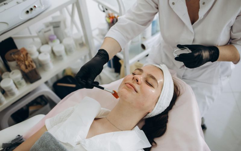 Woman getting a Chemical Peel Face Treatment