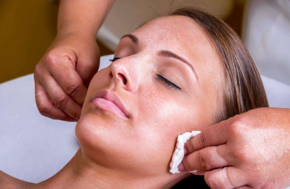 What Is a Chemical Peel