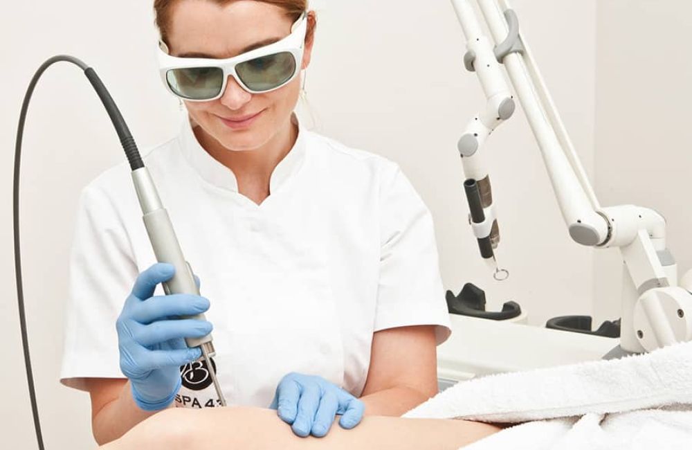 laser hair removal