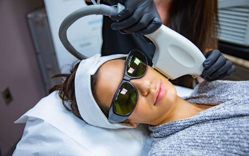 FotoFacial: What is it? Who is it for?