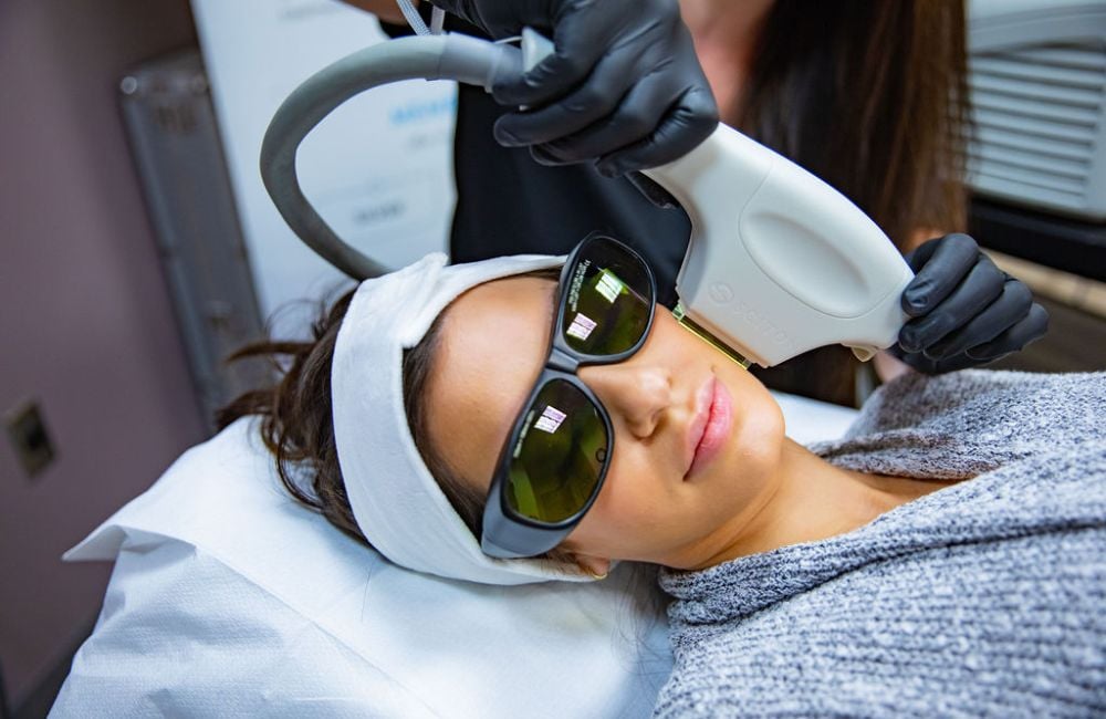 FotoFacial: What is it? Who is it for?