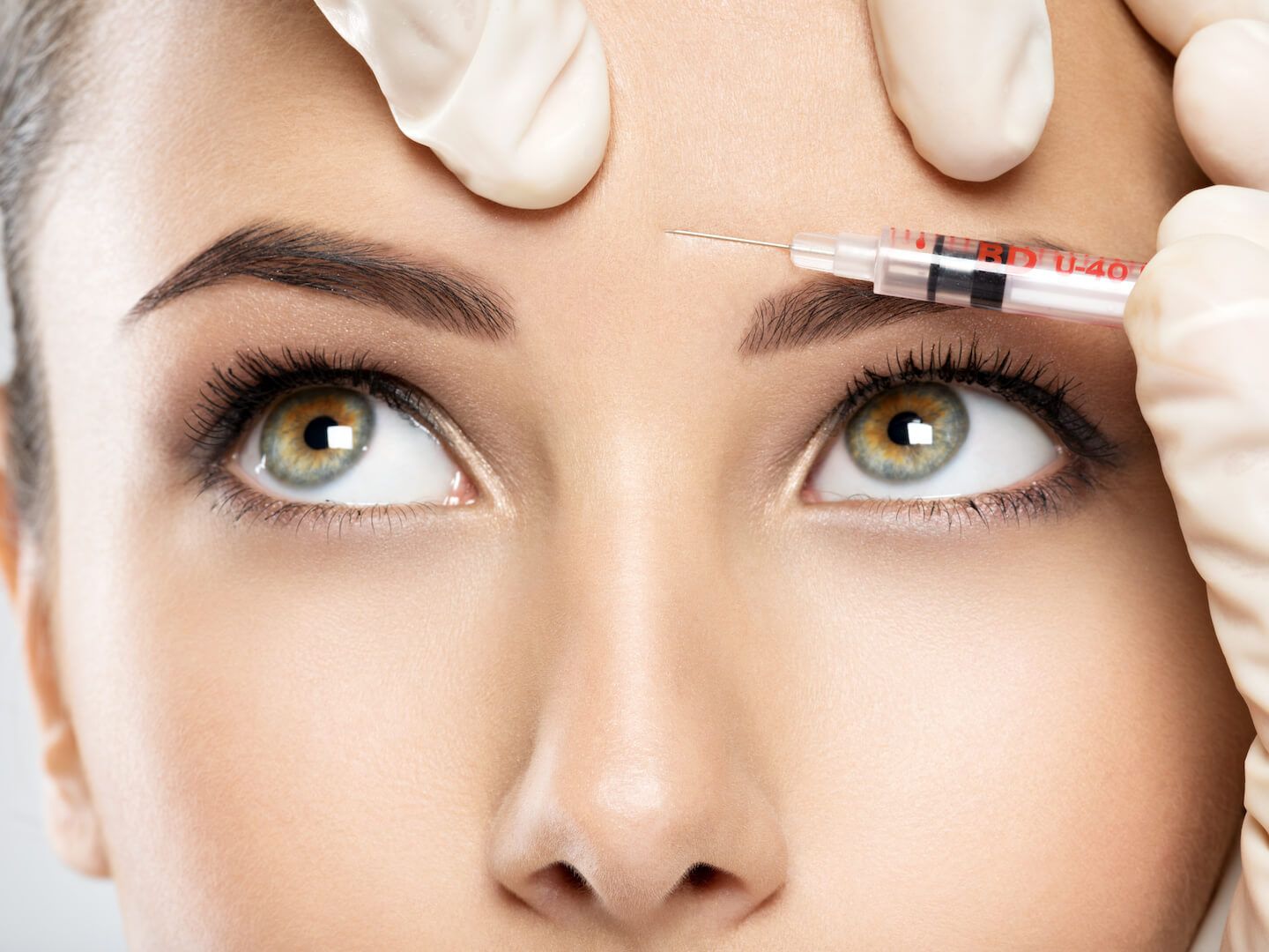 woman getting cosmetic botox injection in forehead (1)