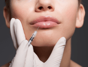 Woman receiving a lip injection with a syringe, close-up on lips and gloved hand, highlighting cosmetic procedure.