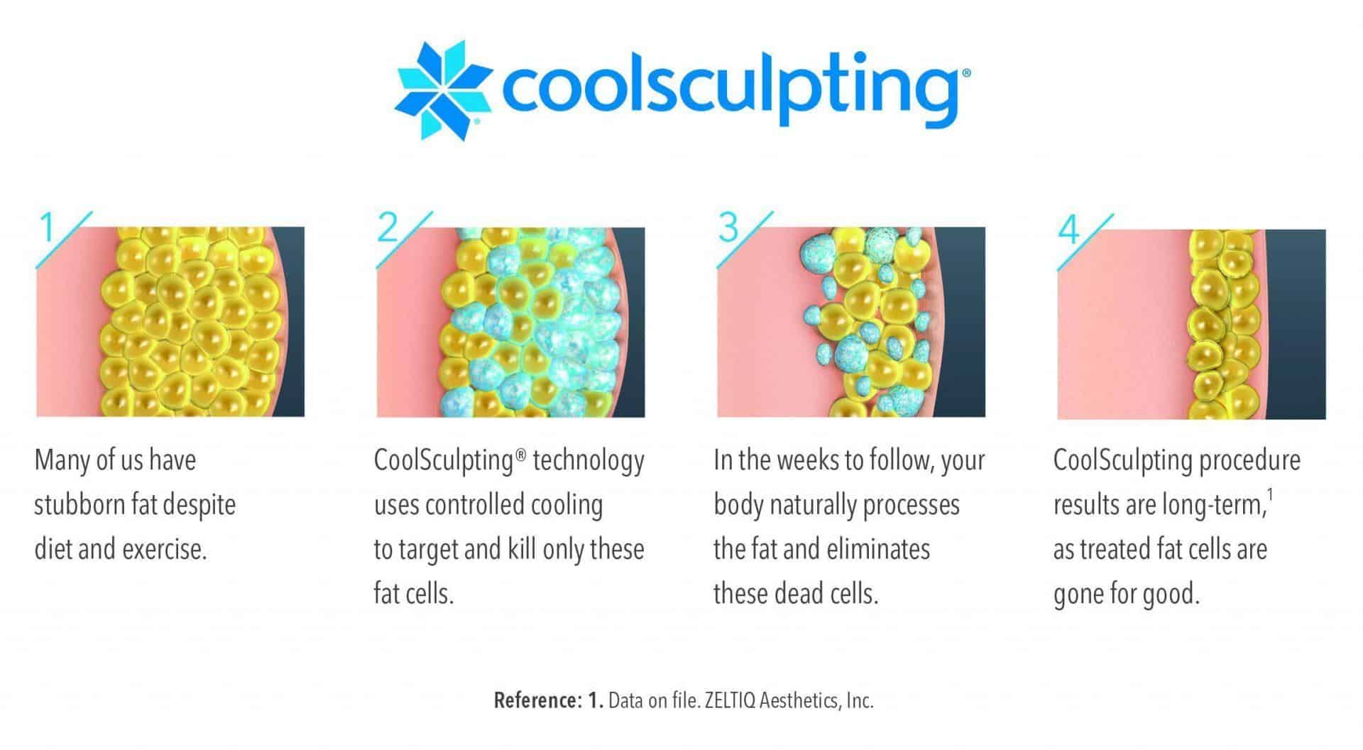 1 CoolSculpting Provider in Hampton Roads - Cool Body Sculpting